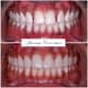 Slider image (7) FMS Dental Hospital - Kukatpally